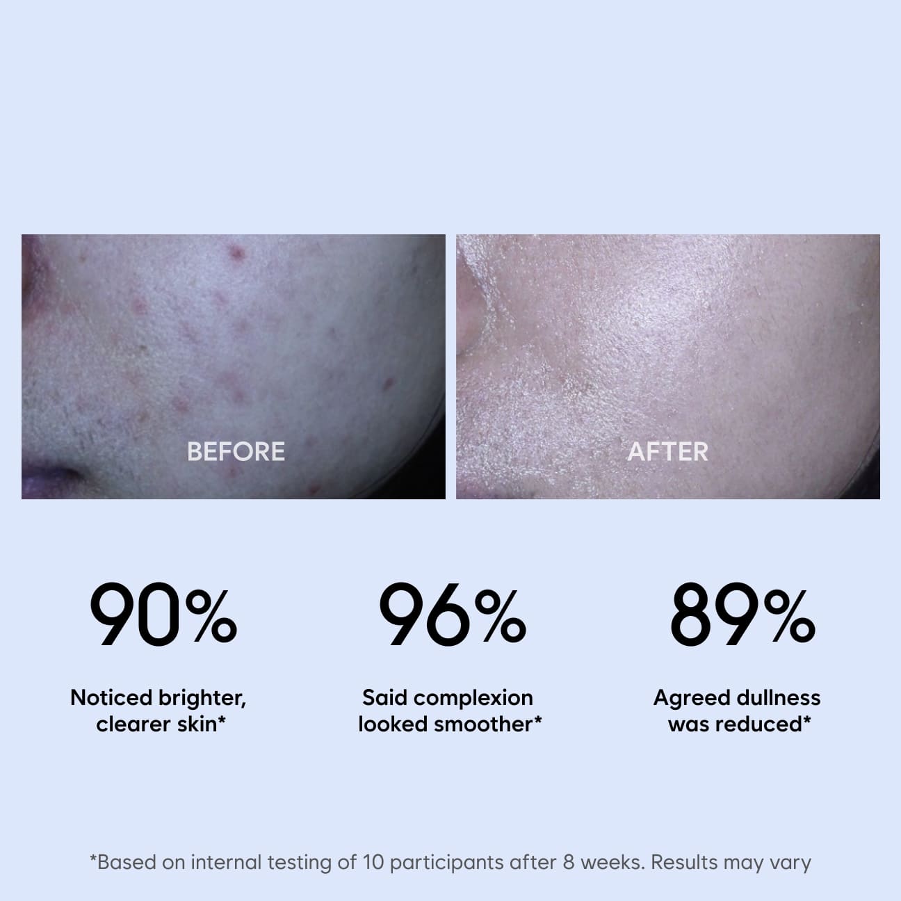 Clear Brightening Moisture Emulsion image 3