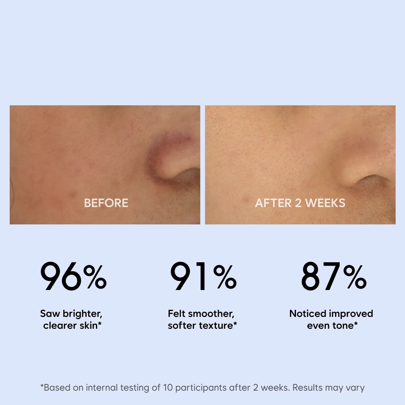 MANDELIC ACID BRIGHTING MASK image 3