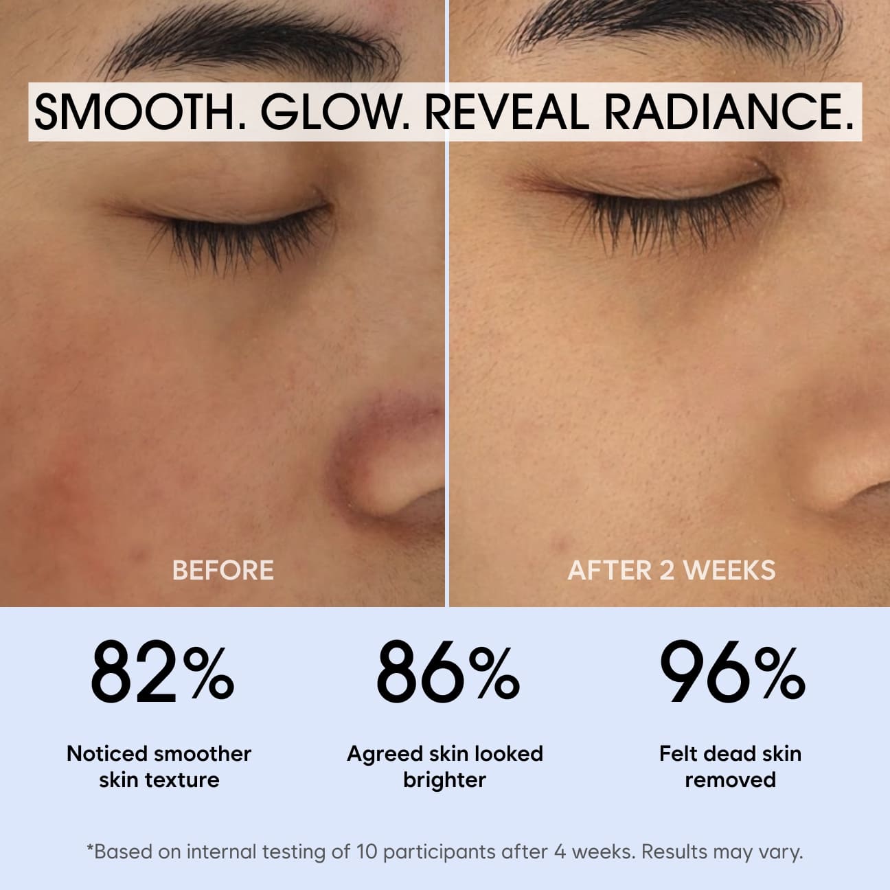 Soft Peeling Gel image 2