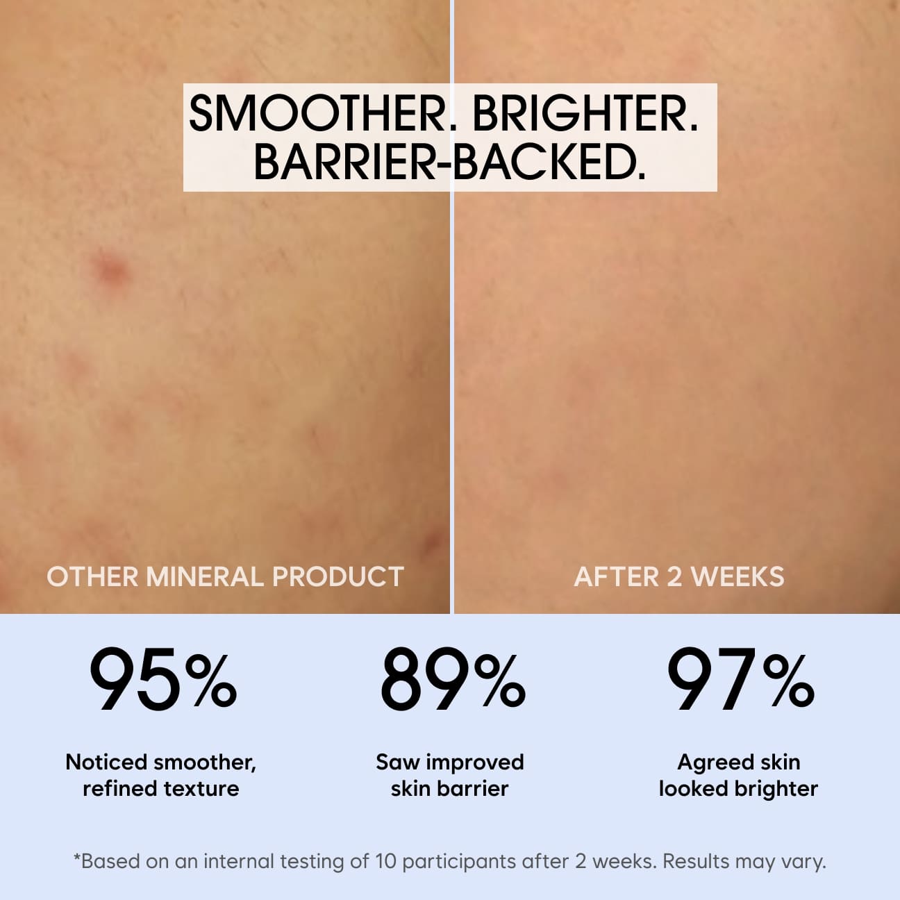 HYBRID INTENSIVE SERUM image 3