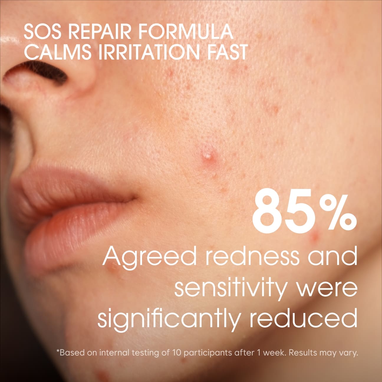 SOS REPAIR CREAM's thumbnail image