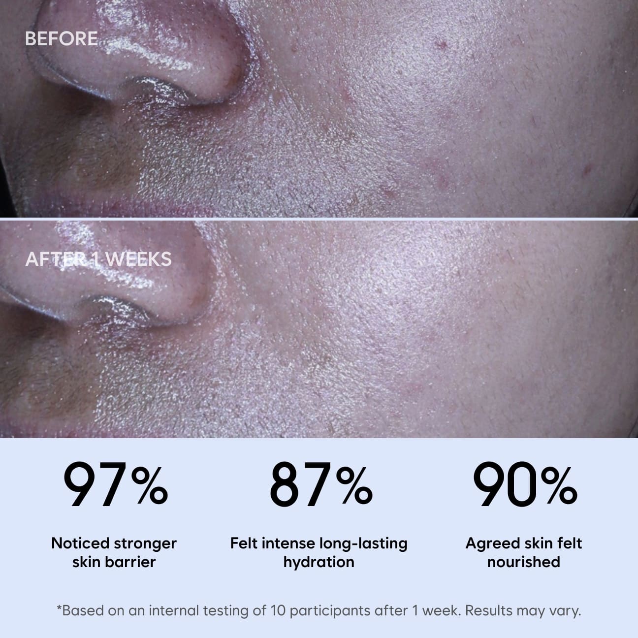 인텐시브 컨디셔닝 크림 image 3