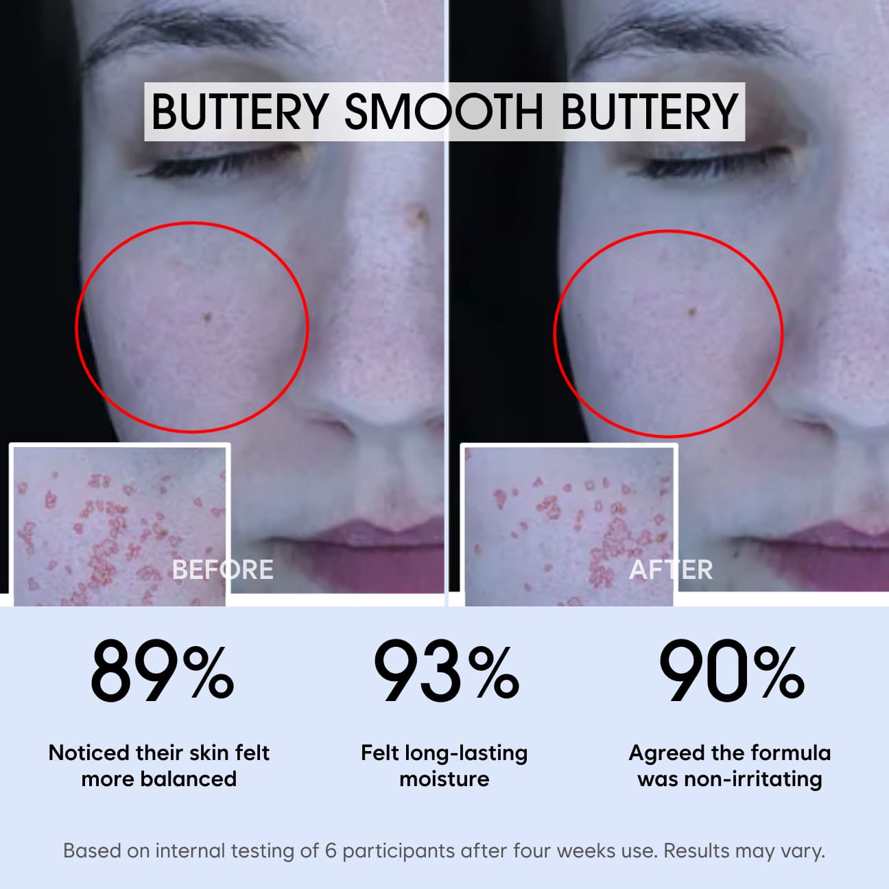 자일리톨 수딩 크림 image 3