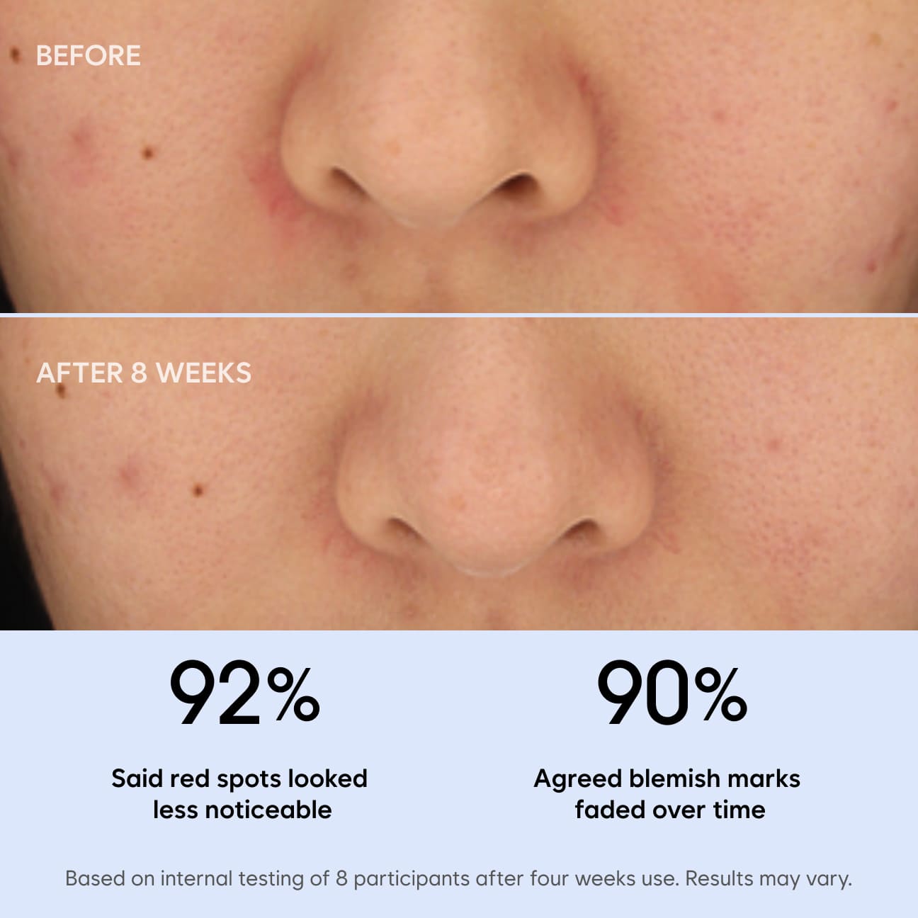 비타 B5+ 징크 PCA 블렌디드 크림 image 3